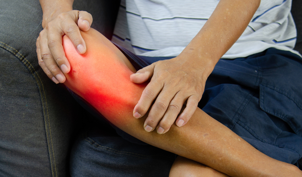 Extremity injury treatment in san antonio, tx